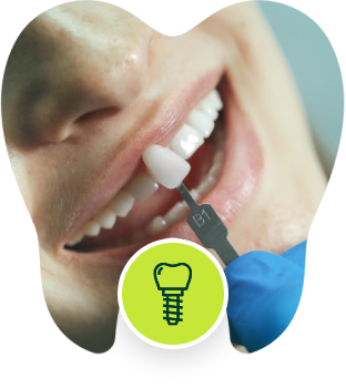 Dental Implants