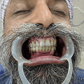 Patient thumbnail 1