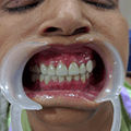 Patient thumbnail 2