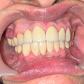 Patient thumbnail 6