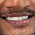 Patient thumbnail 7