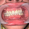 Patient thumbnail 8