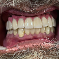 Patient thumbnail 9